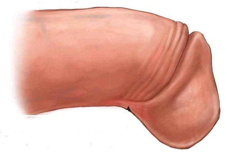 si të zmadhoni penisin glas